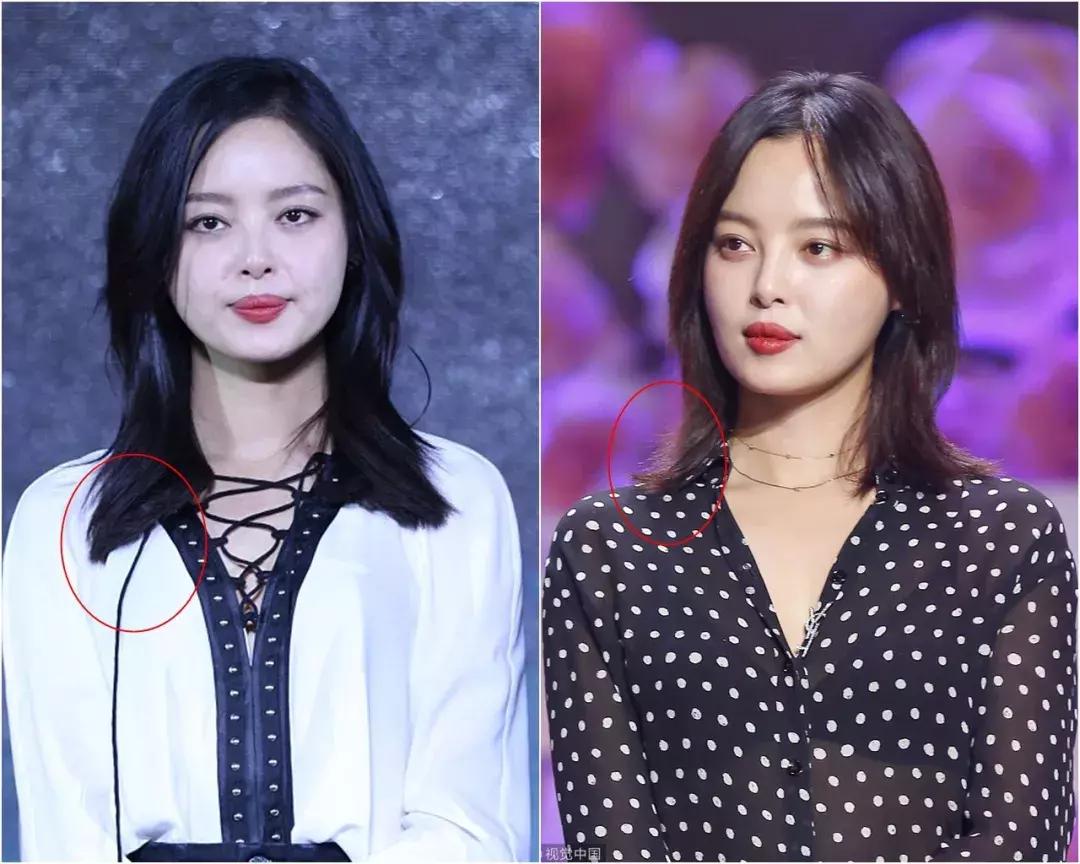 女明星短发造型_辛芷蕾短发分析_短发造型